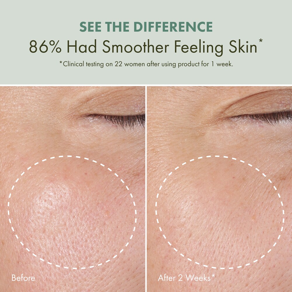 Checks and Balances™ Daily Exfoliating Toner with AHA, BHA and Witch Hazel, 5 fl. oz.