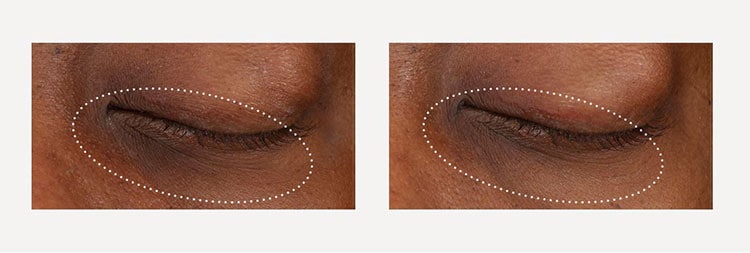 GinZing™ Refreshing Eye Cream to Brighten and Depuff | Origins Germany